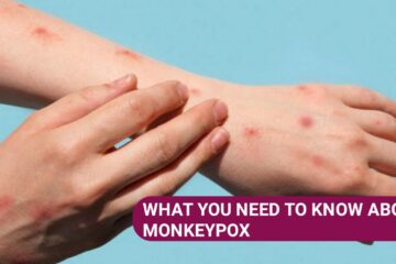 Exploring Monkeypox: Symptoms, Transmission, and Prevention with Pictures